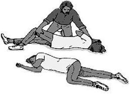 癲癇發(fā)作與癲癇綜合征