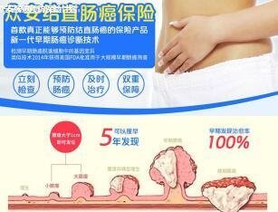 眾安保險險種及產品介紹