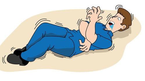 您是怎樣治療癲癇的 患癲癇快十年了能治好嗎