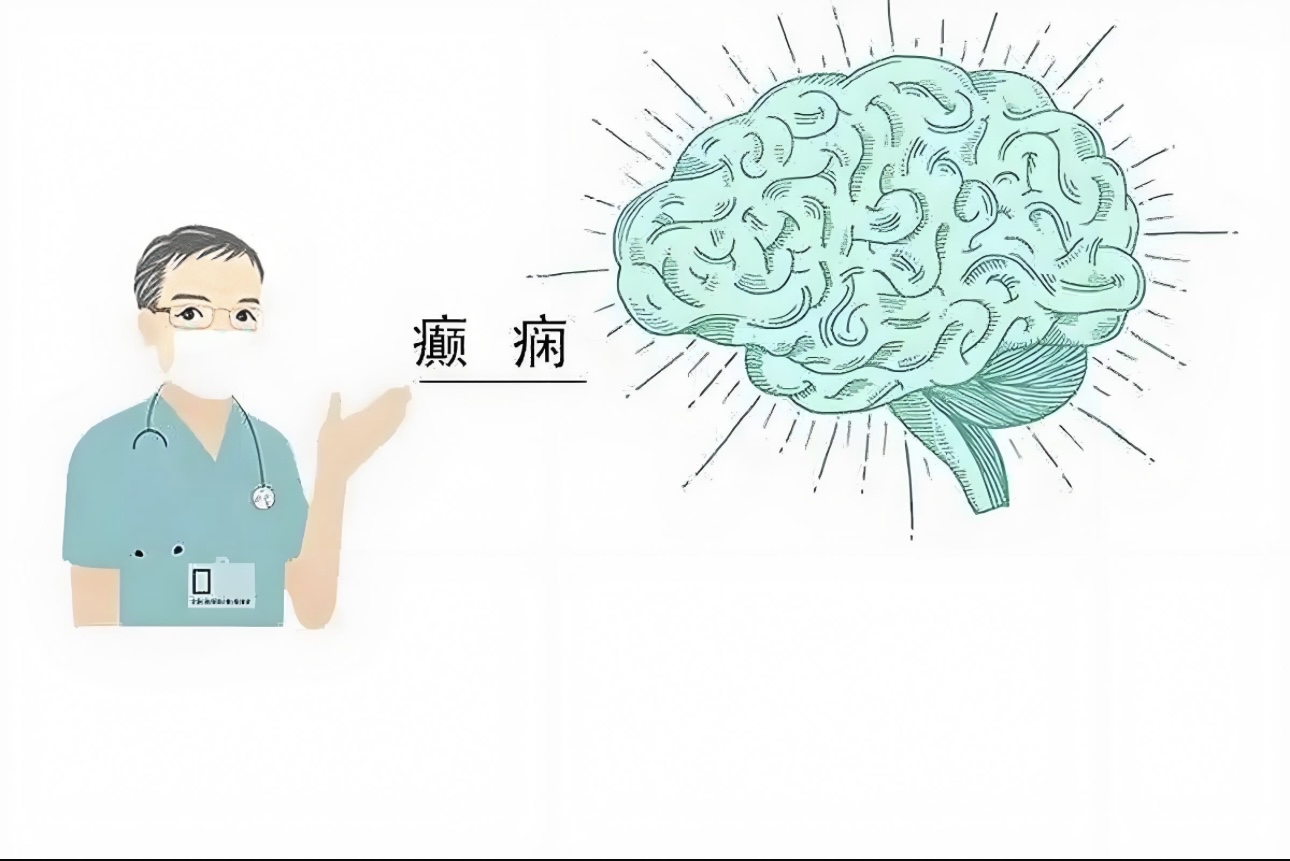 癲癇病是一種腦部異常放電導致的慢性疾病,主要