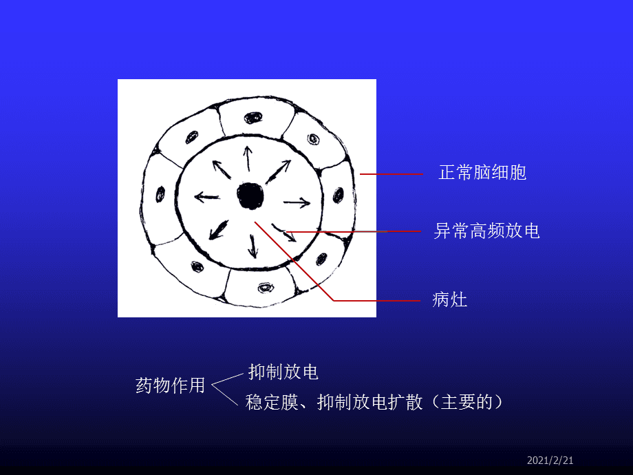 癲癇藥與抗驚厥藥 作用機制、分類及應用綜述