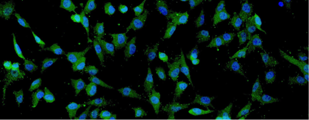 細胞外囊泡療法 癲癇治療的新希望